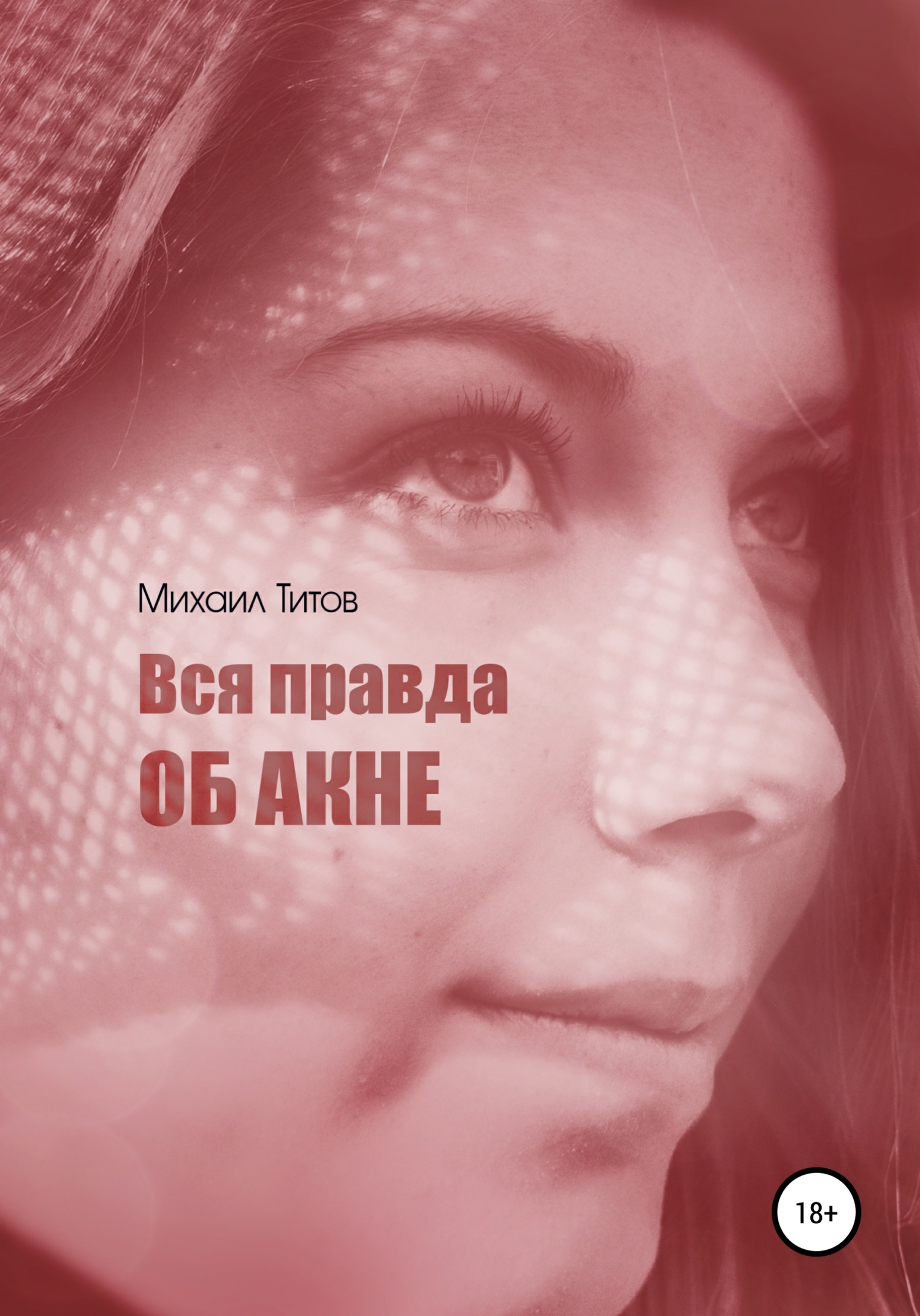 Вся правда об&nbsp;акне